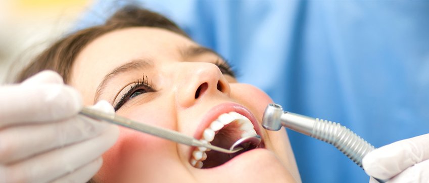 Wisdom Tooth Extraction - Seville Dental Clinic